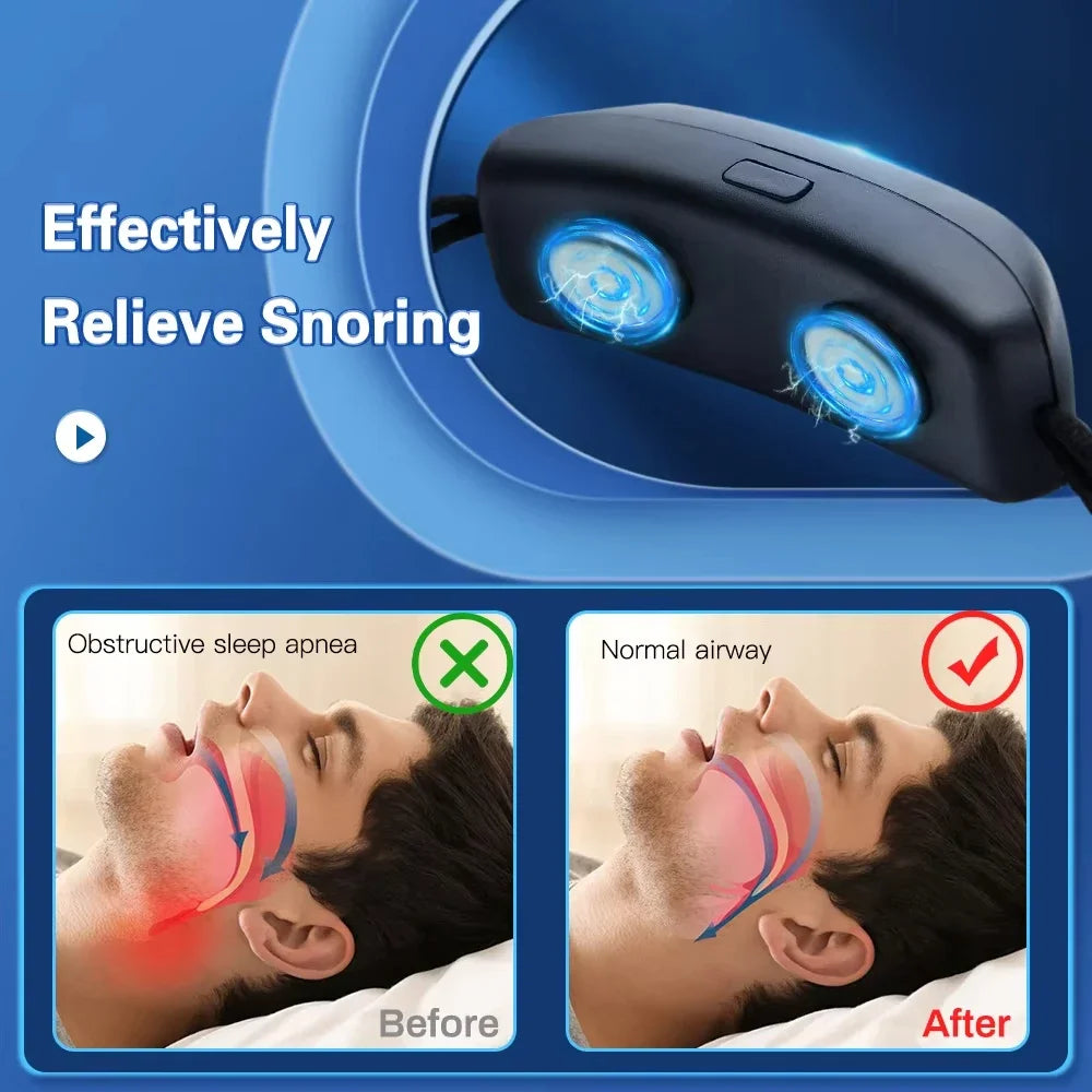 Smart EMS Anti-Snoring Sleep Aid Device